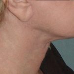 Thumbnail another photo of the patient’s after