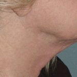 Thumbnail another photo of the patient’s before