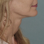 Thumbnail another photo of the patient’s after