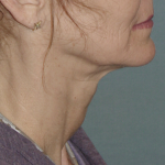 Thumbnail another photo of the patient’s before