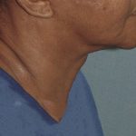 Thumbnail another photo of the patient’s after