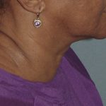 Thumbnail another photo of the patient’s before