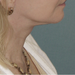 Thumbnail another photo of the patient’s after