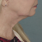 Thumbnail another photo of the patient’s before