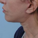 Thumbnail another photo of the patient’s after