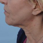 Thumbnail another photo of the patient’s before