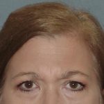 Thumbnail another photo of the patient’s before