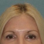 Thumbnail another photo of the patient’s after