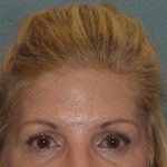 Thumbnail another photo of the patient’s before