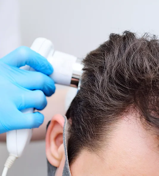 How Is the Hair Restoration Procedure Performed at FSIBR? - female photo