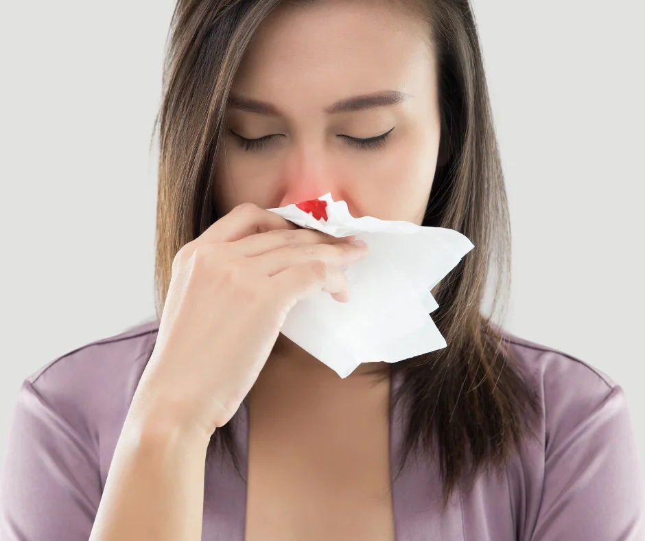 Female With a Swollen Bleeding Nose