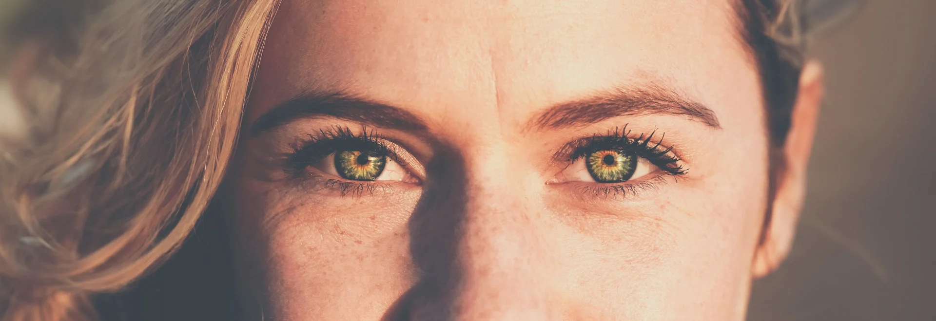 Drooping eyebrows: Close-up of woman’s eyes showing sagging eyebrow position