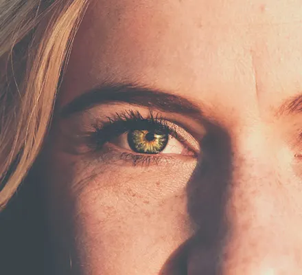 Drooping eyebrows: Close-up of woman’s eyes showing sagging eyebrow position
