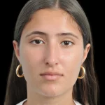 Thumbnail photo of the patient’s before the Rhinoplasty Patient 29
